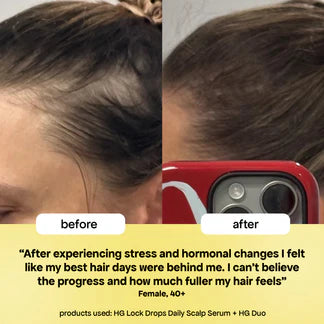 Bondi Boost Lock Drops anti-shedding scalp & hair serum