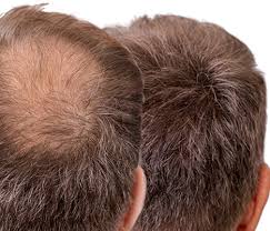 Hi Lift Hair Building Fibres 25g Dark Brown