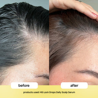 Bondi Boost Lock Drops anti-shedding scalp & hair serum